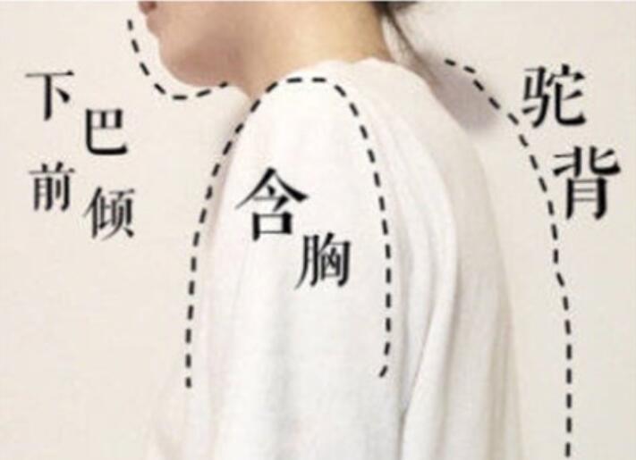 南寧美容學(xué)校：堅持一個月，駝背變直背