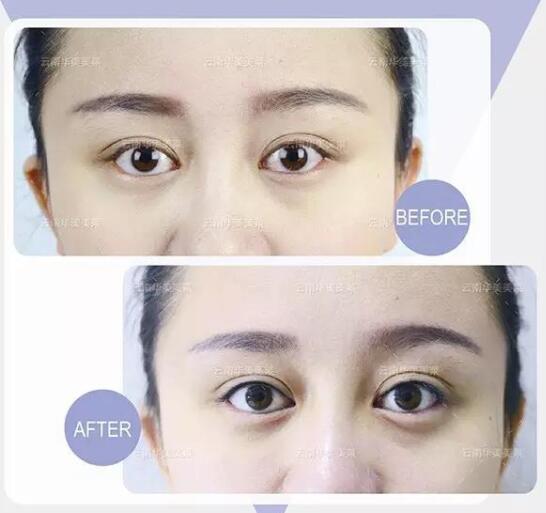 南寧紋繡學(xué)校：眼線一紋，勾人銷(xiāo)魂
