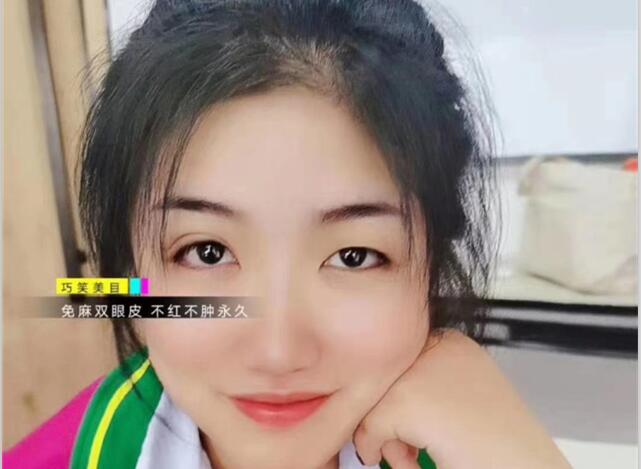 麗竹學(xué)?！凹y繡+雙眼皮”課程開講