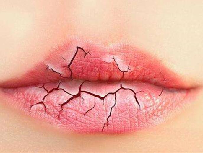 6個美容技巧，解決秋季嘴唇干燥