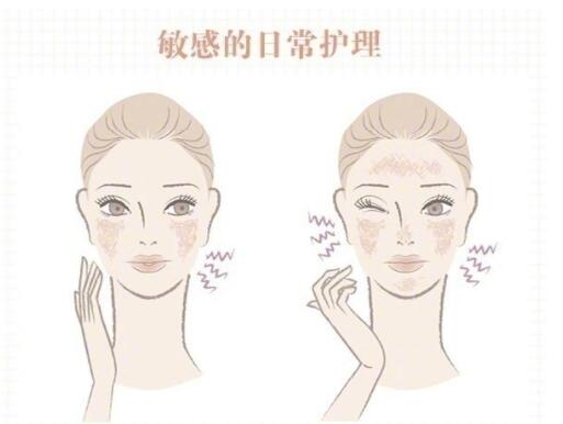 敏感肌保養(yǎng)大全！