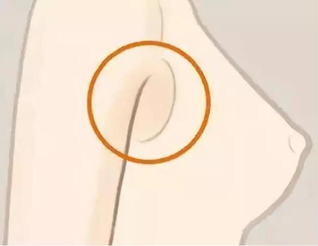 減副乳，瘦手臂一招就解決！