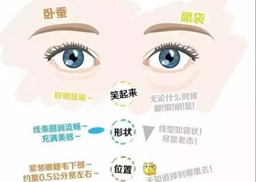 眼袋還是臥蠶，快來學(xué)辨別的方法