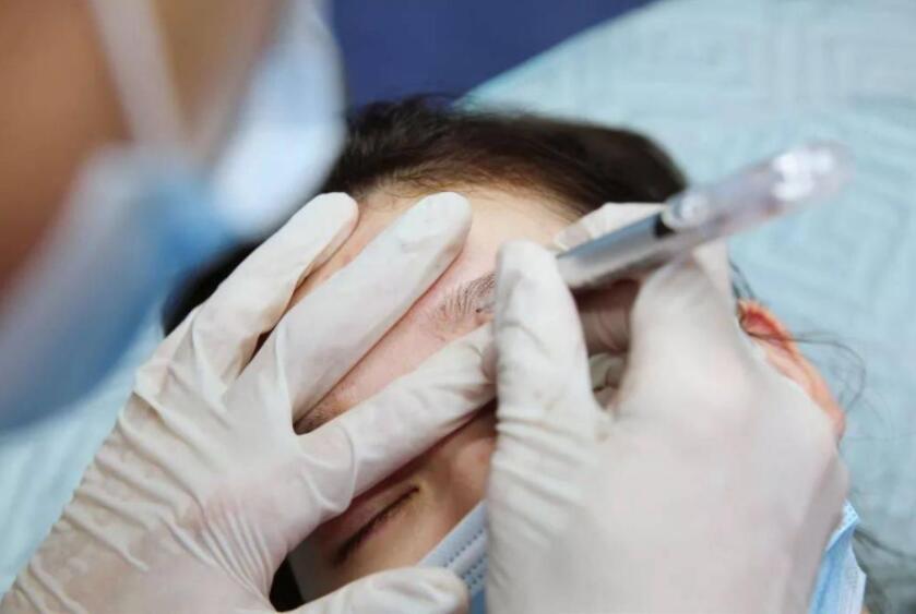 紋繡遇到容易出血的皮膚怎么辦？南寧專業(yè)紋繡培訓教你