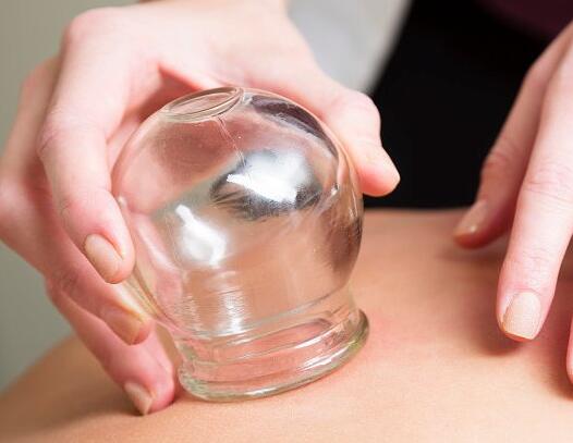 4種不同的拔罐方法，廣西美容學校整理好了