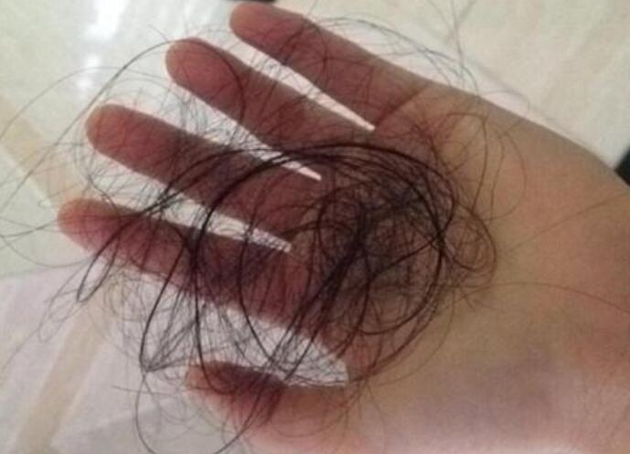 脫發(fā)女孩必備寶典！南寧美發(fā)學校教你