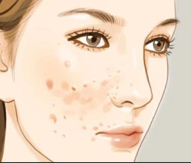 廣西美容師培訓(xùn)正規(guī)學(xué)校：專(zhuān)治色斑的寶藏水果