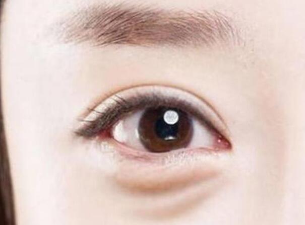 眼袋？淚溝？臥蠶？南寧美容學校教你辨別