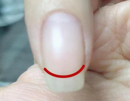 廣西美甲資訊：什么是扇形甲？