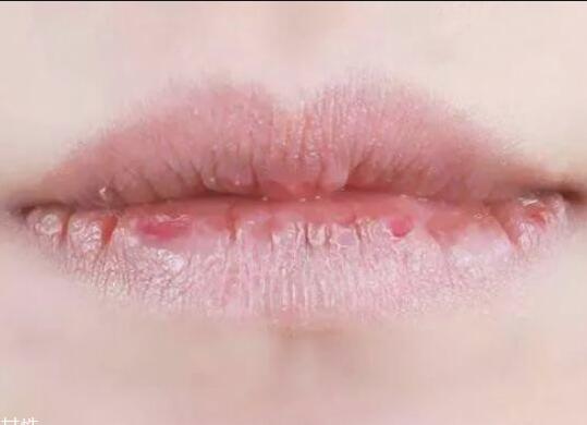 紋唇后嘴巴干燥怎么辦？南寧教紋繡的學(xué)校幫你解決