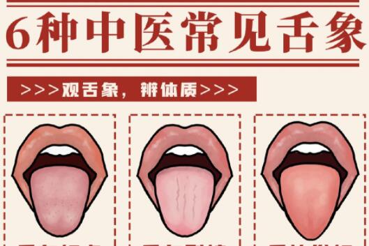 6種常見中醫(yī)舌診判定，快和廣西中醫(yī)美容一起學(xué)