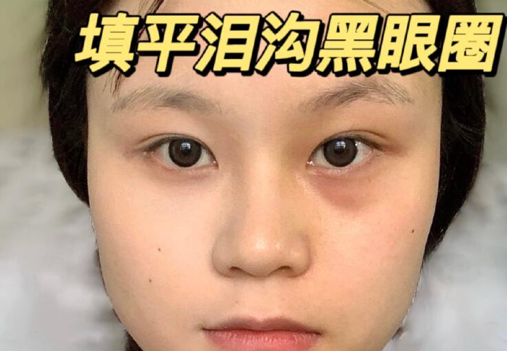 填平淚溝黑眼圈教程，廣西南寧化妝學校分享