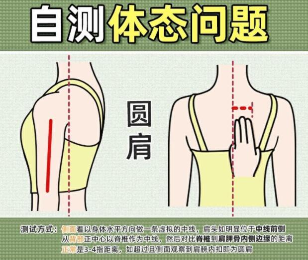 你真的是駝背嗎？廣西美容美體學校教你自測