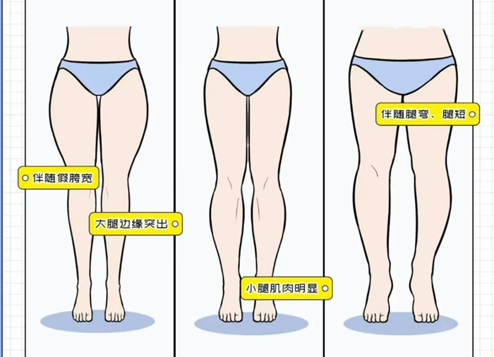 腿粗女生穿搭攻略，廣西彩妝造型搭配