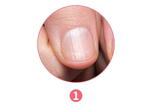 女生氣血不足六大表現(xiàn)，南寧美容養(yǎng)生資訊報道