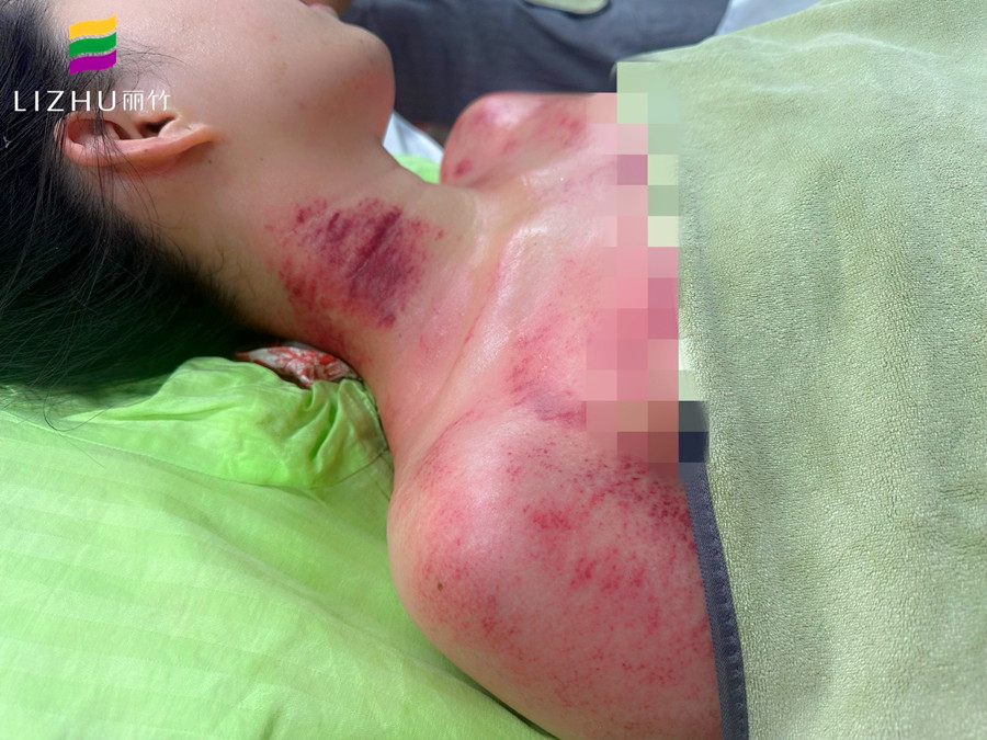 廣西學(xué)刮痧培訓(xùn)班 | 廣西學(xué)刮痧學(xué)費(fèi)多少？