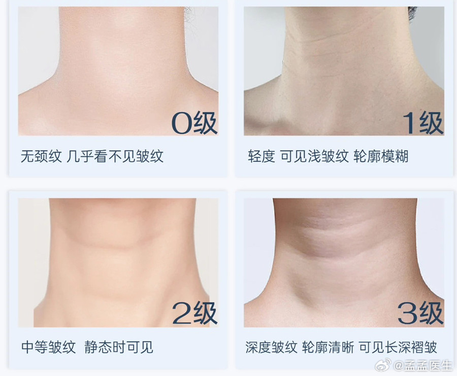 如何緩解頸紋？南寧美體美容管理培訓(xùn)