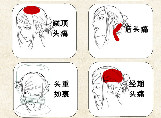 不同頭痛類型經(jīng)絡(luò)護(hù)理方法，廣西中醫(yī)美容培訓(xùn)