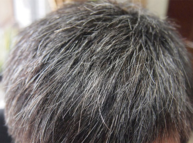 南寧美發(fā)基礎(chǔ)教學(xué)：為什么會長白頭發(fā)？