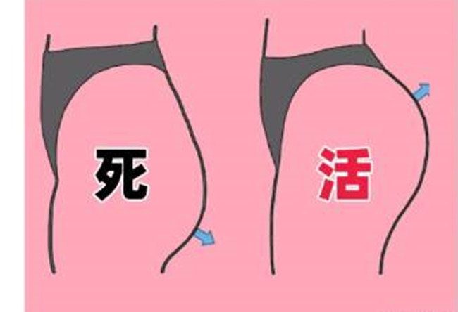 如何改善你臀部的健康情況？南寧美容形象